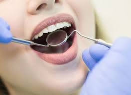 Routine Dental Visit